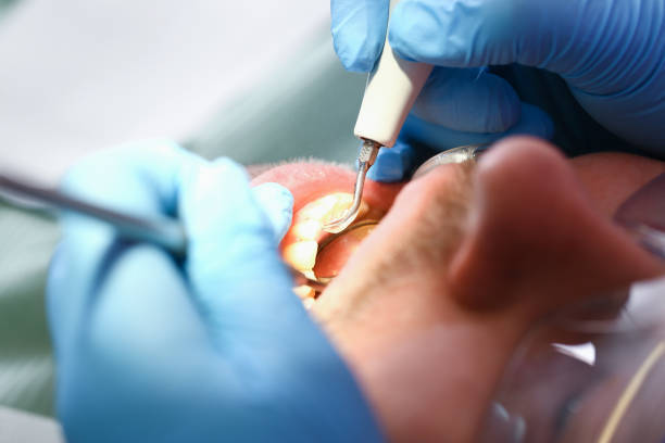 Best Emergency Treatment for Toothache in Corning, AR